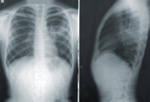 Medical Malpractice Attorney Atlanta